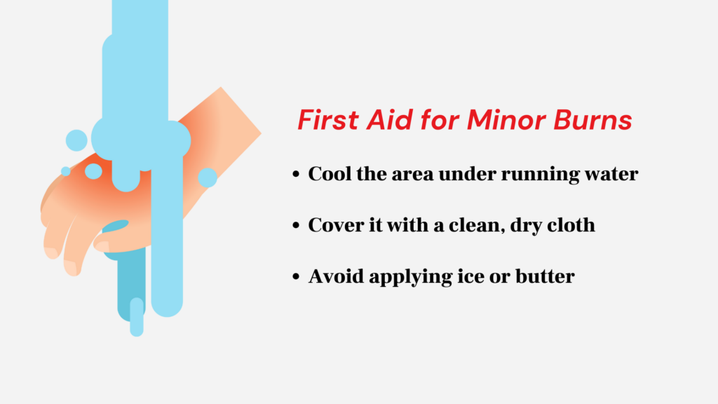 minor burn response infographic